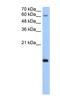 RNA Polymerase II Subunit H antibody, NBP1-53016, Novus Biologicals, Western Blot image 