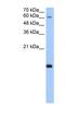 RNA polymerase II RBP8 antibody, NBP1-53016, Novus Biologicals, Western Blot image 