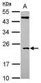 Rho-related GTP-binding protein RhoQ antibody, GTX115991, GeneTex, Western Blot image 