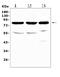 Vesicle-fusing ATPase antibody, A00585, Boster Biological Technology, Western Blot image 