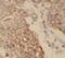 Tubulin Alpha 1a antibody, FNab00082, FineTest, Immunohistochemistry paraffin image 