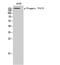 PEAK1 Related, Kinase-Activating Pseudokinase 1 antibody, A32113Y413, Boster Biological Technology, Western Blot image 