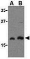 MTOR Associated Protein, LST8 Homolog antibody, GTX31711, GeneTex, Western Blot image 