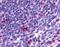 C-C Motif Chemokine Receptor 2 antibody, NLS1899, Novus Biologicals, Immunohistochemistry frozen image 