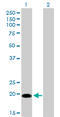 Centrin 1 antibody, LS-C196899, Lifespan Biosciences, Western Blot image 