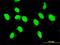 Mixed Lineage Kinase Domain Like Pseudokinase antibody, H00197259-M02, Novus Biologicals, Immunofluorescence image 