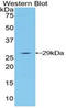 Lymphocyte Activating 3 antibody, LS-B15026, Lifespan Biosciences, Western Blot image 