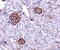 Basigin (Ok Blood Group) antibody, M00248-6, Boster Biological Technology, Immunohistochemistry paraffin image 