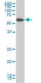 Protein Kinase AMP-Activated Catalytic Subunit Alpha 1 antibody, LS-C133394, Lifespan Biosciences, Western Blot image 