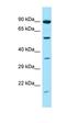 Gamma-2-syntrophin antibody, orb331345, Biorbyt, Western Blot image 