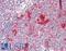 Ribosomal Protein S14 antibody, LS-C211682, Lifespan Biosciences, Immunohistochemistry paraffin image 