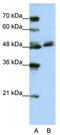 WD Repeat Domain 13 antibody, TA346000, Origene, Western Blot image 