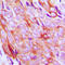 Insulin Like Growth Factor 1 Receptor antibody, LS-C358783, Lifespan Biosciences, Immunohistochemistry paraffin image 