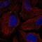 Transmembrane Protein 198 antibody, NBP2-59008, Novus Biologicals, Immunocytochemistry image 