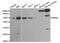 Golgi Associated, Gamma Adaptin Ear Containing, ARF Binding Protein 2 antibody, PA5-75993, Invitrogen Antibodies, Western Blot image 