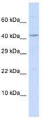 Bone Morphogenetic Protein 10 antibody, TA341940, Origene, Western Blot image 