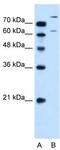 Solute Carrier Family 26 Member 1 antibody, TA333710, Origene, Western Blot image 