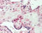 SWI/SNF Related, Matrix Associated, Actin Dependent Regulator Of Chromatin, Subfamily A, Member 4 antibody, LS-B12057, Lifespan Biosciences, Immunohistochemistry paraffin image 