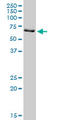 Protein Arginine Methyltransferase 3 antibody, LS-C139235, Lifespan Biosciences, Western Blot image 