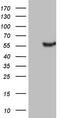 Leucine Rich Repeat Containing 6 antibody, TA806104S, Origene, Western Blot image 