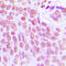 Inositol-Trisphosphate 3-Kinase C antibody, LS-C354205, Lifespan Biosciences, Immunohistochemistry paraffin image 