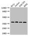 RAD51 Recombinase antibody, LS-C679268, Lifespan Biosciences, Western Blot image 