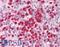 Interleukin-21 antibody, LS-B1364, Lifespan Biosciences, Immunohistochemistry paraffin image 