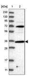Protein Phosphatase 1 Regulatory Subunit 3C antibody, PA5-55493, Invitrogen Antibodies, Western Blot image 