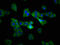 Tetraspanin 9 antibody, LS-C672663, Lifespan Biosciences, Immunofluorescence image 