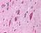 Hematopoietic Cell Signal Transducer antibody, 45-460, ProSci, Western Blot image 