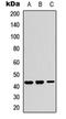 Gamma-Glutamyltransferase 5 antibody, orb234860, Biorbyt, Western Blot image 