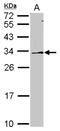 Dimethylarginine Dimethylaminohydrolase 2 antibody, NBP2-16121, Novus Biologicals, Western Blot image 