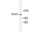 Nitric Oxide Synthase 3 antibody, LS-C177439, Lifespan Biosciences, Western Blot image 