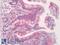 TNF Receptor Superfamily Member 14 antibody, LS-B11001, Lifespan Biosciences, Immunohistochemistry frozen image 