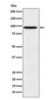 Denticleless E3 Ubiquitin Protein Ligase Homolog antibody, M01255, Boster Biological Technology, Western Blot image 