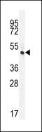 Ras And Rab Interactor Like antibody, 56-231, ProSci, Western Blot image 