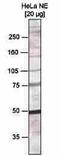 RB Binding Protein 4, Chromatin Remodeling Factor antibody, CI1081, Boster Biological Technology, Western Blot image 