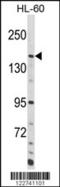 Adenylate Cyclase 8 antibody, MBS9210754, MyBioSource, Western Blot image 