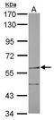 Fanconi anemia group C protein antibody, PA5-29704, Invitrogen Antibodies, Western Blot image 