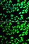 Protein Disulfide Isomerase Family A Member 6 antibody, GTX33397, GeneTex, Immunocytochemistry image 