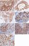 WAP Four-Disulfide Core Domain 2 antibody, GTX02131, GeneTex, Immunohistochemistry paraffin image 