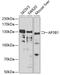 Adaptor Related Protein Complex 3 Subunit Beta 1 antibody, A04904, Boster Biological Technology, Western Blot image 