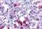Arginine Vasopressin Receptor 1B antibody, NLS266, Novus Biologicals, Immunohistochemistry paraffin image 