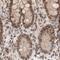 GATA Zinc Finger Domain Containing 2A antibody, PA5-55065, Invitrogen Antibodies, Immunohistochemistry frozen image 