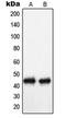 N-Terminal EF-Hand Calcium Binding Protein 3 antibody, MBS820911, MyBioSource, Western Blot image 