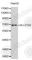 Solute Carrier Family 27 Member 2 antibody, A1077, ABclonal Technology, Western Blot image 