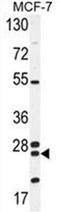 Nudix Hydrolase 8 antibody, AP52965PU-N, Origene, Western Blot image 