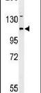 Adenylate Cyclase 4 antibody, PA5-26873, Invitrogen Antibodies, Western Blot image 