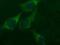 Hypoxanthine Phosphoribosyltransferase 1 antibody, NBP2-46003, Novus Biologicals, Immunofluorescence image 