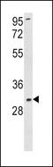 Superoxide Dismutase 3 antibody, LS-C161386, Lifespan Biosciences, Western Blot image 